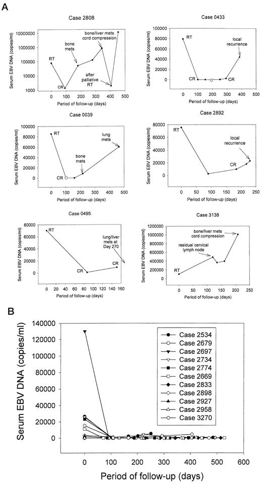 Fig. 2. Longitudinal follow-up of serum EBV DNA in NPC patients with tumor recurrence and those in continuous clinical remission. A, NPC patients who developed tumor recurrence on follow-up. The variation in serum EBV DNA levels for each patient over time is plotted in a separate graph. Key clinical events are indicated in the respective graphs. The scale of the Y axis has been optimized for the concentration range for each case. Linear scales are used throughout except for the Y axis of case 2808, which is in a common logarithmic scale to accommodate the large variations in serum EBV DNA levels. ○, serum EBV DNA level of 0 copy/ml; •, detectable serum EBV DNA. RT, radiotherapy; CR, clinical remission; mets, metastasis. B, composite serum EBV DNA levels from 11 NPC patients who remained in continuous clinical remission. X axis, time from follow-up, with the first day of radiotherapy treatment as day 0. Y axis, serum EBV DNA level in copies/ml.