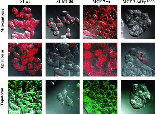 Fig. 2. Photomicrographs obtained by confocal microscopy demonstrating the steady-state levels and localization of 5 μm mitoxantrone, epirubicin, or topotecan in the S1 and MCF-7 parental cells and the S1-M1-80 and MCF-7 AdVp3000 resistant cell lines. wt, wild type.