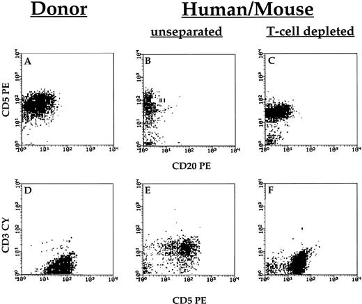 Fig. 2. Phenotypic characterization of donor PBMCs (A and D) and lymphocytes recovered from human→ mouse chimera transplanted with PBMCs (patient number 1) with (C and F) or without (B and E) in vivo treatment with OKT3 antibody to deplete human T cells. Chimera were prepared by conditioning BALB/c mice with split irradiation, followed by radioprotection with SCID BM; thereafter, the mice were transplanted with 120 × 104 PBMC from B-CLL patients. Some of the mice were treated with OKT3 on the day of PBMC transplantation. Cells were recovered from the peritoneal wash 10–14 days after transplantation. Cells were typed by triple staining with anti CD20, CD5, and CD3 antibodies. T cells were typed as CD20−CD5+CD3+, and CLL cells were typed as CD20+CD5+CD3−.