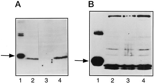 Fig. 3. SDS-PAGE and subsequent immunoblotting of dCK (A) and dGK (B) analyses with the purified recombinant dCK and dGK (Lane 1), cell line HL60 (Lane 2), and its CdA (Lane 3) and Fara-A (Lane 4) resistant sublines. The amount of crude protein applied on the gel was 40 μg/lane, and the amount of recombinant dCK and dGK was 2 μg. The recombinant enzymes contained a histidine tag at the NH2-terminal, which adds Mr 2000–3000 to the respective enzyme.