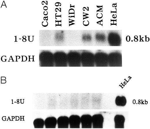 Fig. 3. A, expression of 1-8U mRNA in cancer cell lines. The human colon carcinoma cell lines HT29, Caco2, ACM, WiDr, and CW2 were used. A human cervical cancer cell line, HeLa, was also used. B, expression of 1-8U mRNA in normal colon mucosa from healthy volunteers. Six representative samples of 1-8U mRNA expression in normal colon mucosa are shown. HeLa was used as a positive control.
