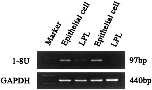 Fig. 4. Expression of 1-8U mRNA in freshly isolated colonic epithelial cells (Epithelial cell) and LPLs from severely inflamed colonic mucosa of a UC patient. Ethidium bromide staining of the PCR products by DD40 primers is shown.