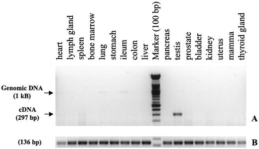 Fig. 3. A, CTp11 RT-PCR on RNA isolated from 17 different fresh normal human tissues. Only testis is positive (297-bp cDNA band). In a few samples, a weak genomic DNA band is visible (1 kb). B, control RT-PCR of β2-microglobulin (136 bp).