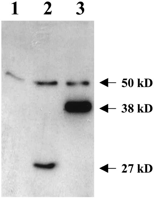 Fig. 5. Western blot analysis of cell lysates from BLM (Lane 1), BLM transfected with a construct containing only eGFP (Lane 2), and BLM with a construct containing the full-length cDNA/eGFP fusion construct (Lane 3). Bands were visualized by incubation with a polyclonal antibody against eGFP. Note that the 27- and 38-kDa bands are specific and that the band at 50 kDa is aspecific.
