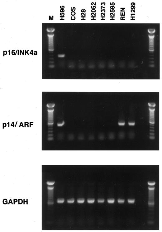 Fig. 1. RT-PCR analysis of p16 and ARF expression in cultured mesothelioma and lung cancer lines. PCR primers specific for p16ink4a (top panel) and alternatively spliced p14/ARF (middle panel) were used to amplify corresponding 300- and 450-bp products from cultured mesothelioma cell lines (H28, H2052, H2373, H2595, and REN), H-596 and H1299 lung cancer cells, and COS-7 green African monkey kidney cells. Bottom panel, glyceraldehyde-3-phosphate dehydrogenase (GAPDH)-specific products confirming MRNA integrity.
