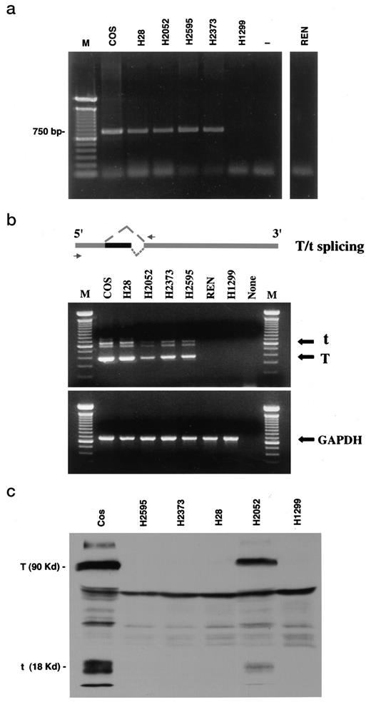 Fig. 2. a, genomic PCR analysis of integrated SV40 T antigen region in mesothelioma cell lines. Primers encompassing the first 750 bp of the T/t coding region were used for DNA amplification. M, 100-bp DNA ladder; COS, African green monkey kidney fibroblasts immortalized with multiple copies of SV40 sequences; H28, H2052, H2595, H2373, and REN, mesothelioma cell lines; H1299, a lung adenocarcinoma cell line; −, PCR control without any added template DNA. b, RT-PCR analysis of T/t expression in mesothelioma cells. As shown in the above schematic, RT-PCR primers (arrows) would amplify two distinct products as a result of RNA splicing. The larger bands (660 and 600 bp) correspond to the spliced forms of small t transcript, whereas the smaller (380-bp) band is the spliced first exon of large T mRNA. Bottom panel, a 650-bp PCR product of the glyceraldehyde-3-phosphate dehydrogenase (GAPDH) transcript that was used as an internal RNA loading control. The RT-PCR reactions for T/t RNA were performed under conditions described in the text. c, immune-precipitation and Western blot analysis of T/t gene products in mesothelioma cells. Total cell lysates were incubated with the NH2-specific monoclonal antibody Pab 108, and the antibody-antigen immune complexes were precipitated with agarose-linked protein A. Western blot analysis of the complexes using the same monoclonal Pab 108 showed expression of large T (Mr 90,000) as well as small t (Mr 18,000) in H2052 and COS-7 cells.
