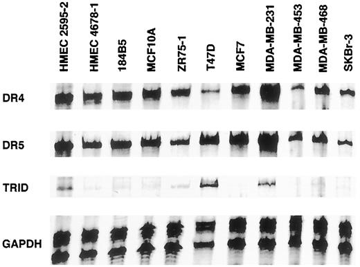 Fig. 3. Expression of DR4, DR5, and TRID in breast cell lines. Expression of DR4, DR5, and TRID was assessed by RNase protection assay. No expression of TRID was demonstrated in MDA-MB-453, even with longer exposures. Glyceraldehyde-3-phosphate dehydrogenase (GAPDH) expression is shown as a loading control.