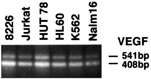 Fig. 1. RT-PCR analysis of VEGF transcripts in human hematopoietic tumor cell lines. VEGF-121 (408 bp) and VEGF-165 (541 bp) were detected in all of the cell lines examined.