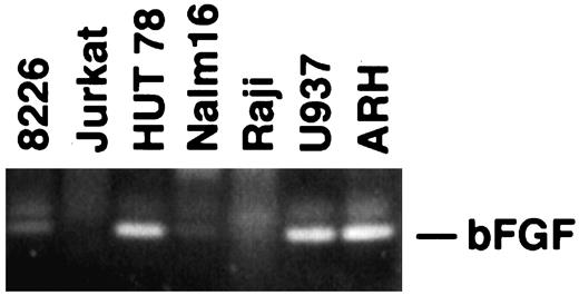 Fig. 2. RT-PCR analysis of bFGF transcripts (237 bp) in human hematopoietic tumor cell lines revealed expression in 6 of 12 cell lines examined.