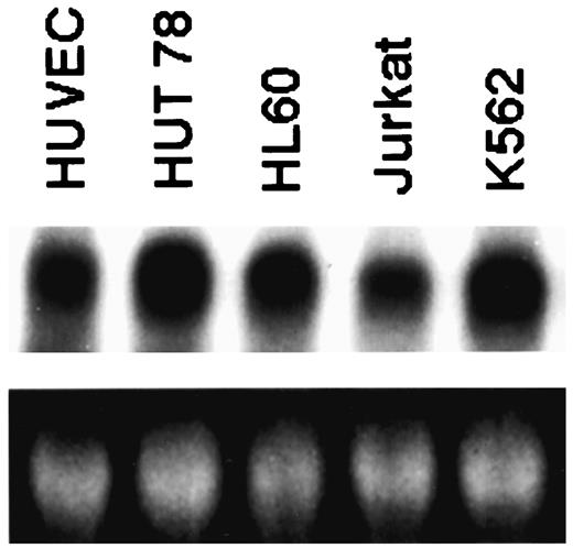 Fig. 3. Northern blot analysis of VEGF expression in human hematopoietic tumor cell lines. Total cellular RNA (5 μg) was loaded into each lane, fractionated in a 1% agarose-formaldehyde gel, and transferred to a Nytran (Schleicher & Schuell) nylon membrane. Before transfer, the fractionated RNAs in the gel were stained with ethidium bromide to confirm equal loading (bottom panel). The membrane was probed with a 32P-labeled cDNA probe specific for VEGF. HUVECs were included as a positive control for VEGF expression.