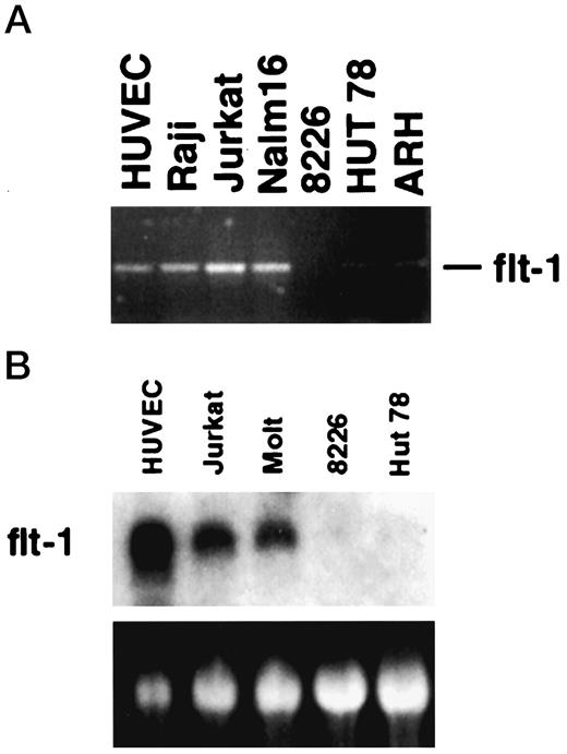Fig. 4. A, RT-PCR analysis of Flt-1 transcripts in human hematopoietic tumor cell lines. A 1098-bp band derived from Flt-1 mRNA was clearly detected in several of the cell lines examined. The Raji, Jurkat, and Molt cell lines demonstrated a level of expression comparable with the HUVEC cell line, whereas the ARH-77 and HUT-78 cell lines displayed a lower level of expression. No evidence of Flt-1 expression was observed in the 8226 cell line. B, Northern blot analysis of Flt-1 transcript in human hematopoietic tumor cell lines. Total cellular RNA (5 μg) was loaded into each lane, fractionated in a 1% agarose-formaldehyde gel, and transferred to a Nytran (Schleicher & Schuell) nylon membrane. Before transfer, the fractionated RNAs in the gel were stained with ethidium bromide to confirm equal loading (bottom panel). The membrane was probed with a 32P-labeled cDNA probe specific for Flt-1. HUVECs were included as a positive control for Flt-1 expression.