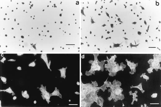 Fig. 4. Bombesin-stimulated spreading of Isreco1 cells. Cells (5 × 104/well) were seeded in 24-well plates and cultured for 24 h in the absence (a and c) or the presence (b and d) of 100 nm bombesin. a and b, Coomassie blue staining, ×125 (scale bars = 30 μm). Note the frequent veil-like protrusions (lamellipodia) in cells cultured with bombesin. c and d, fluorescein-phalloidin staining, ×200 (scale bars = 20 μm). Note the absence of stress fibers and the concentration of actin in multiple veil-like protrusions at the periphery of the cell in cells cultured with 100 nm bombesin.