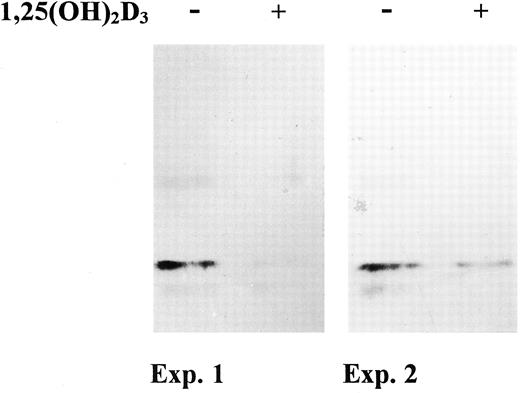 Fig. 3. The effect of 1,25(OH)2D3 on Cu/Zn SOD protein content in MCF-7 cells. MCF-7 cells were treated for 96 h with 1,25(OH)2D3 (100 nm). Cell extracts were prepared, subjected to SDS-PAGE, immunoblotted with a mAb for human Cu/Zn SOD, and visualized by enhanced chemiluminescence.