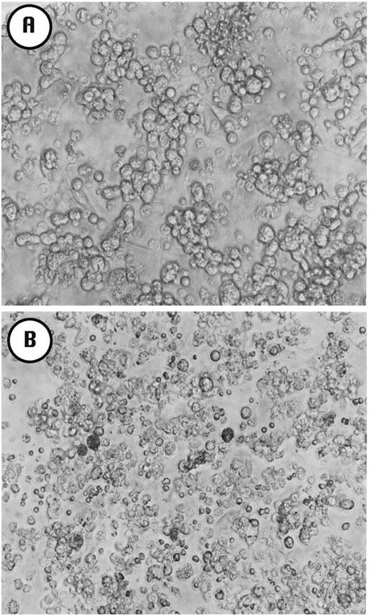Fig. 3. Phase-contrast microscopy of C15 cells cultured in vitro, with or without treatment by a CD95 agonist (7C11). A, C15 cells (5 × 10 5 cells/well in a 24-well plate) incubated for 14 h with control IgM; B, C15 cells incubated for 14 h with the 7C11 Ab (100 ng/ml). Magnification: ×125.