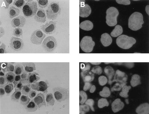 Fig. 3. As2O3-induced morphological and molecular changes characteristic of apoptosis in NCI cells. Cytospin slides of NCI cells incubated with (C and D) or without (A and B) 10−6m As2O3 during 18 h were stained by the 4′-6-diamidino-2-phenylindole nuclear coloration (B and D) or by an in situ TUNEL assay using FITC-conjugated dUTP with detection of incorporated fluorescein by anti-fluorescein antibodies conjugated with alkaline phosphatase (A and C).