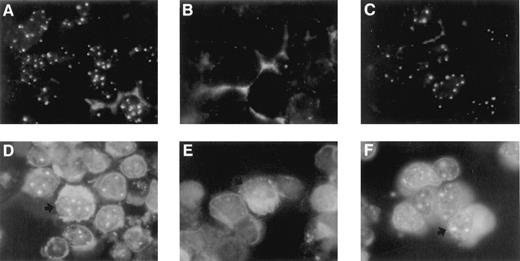 Fig. 7. Indirect intracytoplasmic immunofluorescence staining performed on cytospin slides of NCI cells (upper panels) and of peripheral blood mononuclear cells from a normal donor exposed to PWM for 5 days (lower panels), using polyclonal antibodies directed against the PML protein and fluorescein-conjugated anti-rabbit immunoglobulin antibodies. PWM-treated cells were costained with rhodamine-conjugated antibodies directed against human immunoglobulin chains. NCI cells were incubated for 3 days with IFN-α (1000 UI/ml; A), IFN-α plus 10−6m As2O3 (B), or IFN-α plus 10−6m melarsoprol (C). Normal mononuclear cells were cultured in the presence of PWM without (D) or with (E) 10−6m As2O3 or 10−6m melarsoprol (F). In controls (A and D), most cells showed a nuclear speckled staining pattern typical of PML. Exposure to As2O3 led to a marked decrease of the number of PML bodies (B and E), whereas melarsoprol did not affect the PML nuclear localization either in NCI cells (C) or in PWM-exposed normal mononuclear cells (F). Among the latter, the differential pattern of PML expression was observed in most cells, including in plasma cells (arrows).