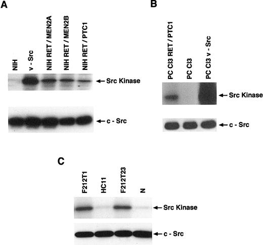 Fig. 2. A, Src kinase activity in NIH3T3 cells expressing different activated forms of RET. Cell lysates from NIH3T3 cells and NIH3T3 cells expressing v-Src or activated RET oncogenes were prepared, and Src kinase was immunoprecipitated. Half of the immunoprecipitates were subjected to kinase assays (top), and half were subjected to Western blot analysis (bottom), as indicated (arrows). B, Src kinase activity in thyroid cells. Parental PCCl3 cells were compared to RET/PTC1 and v-Src expressing cells for Src kinase activity. Src kinase assays and immunoblots were performed as described above. C, Src kinase activity in RET/PTC1-induced mammary tumors. Src kinase activity was evaluated in cell lines derived from two independent mammary adenocarcinomas explanted from RET/PTC1 transgenic animals, F212T1 and F212T23, in a normal mouse mammary epithelial cell line (HC11) and in a normal mouse mammary gland (N), derived from three independent nontransgenic littermates (one is shown; the other two gave consistent results). Src kinase assays and immunoblots were performed as described above. Arrows, positions of Src kinase detected by either kinase assay (top arrow) or Western blot analysis (bottom arrow).