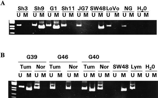 Fig. 2. Hypermethylation of hMLH1 promoter region CpG island in primary human gastric carcinomas. The presence of PCR product in lanes marked U indicates unmethylated hMLH1; product in lanes marked M indicates hypermethylated hMLH1. Water (H2O) serves as negative control for the PCR reaction (A and B). All primary tumors display weak unmethylated bands resulting from contaminating normal cells. Left, marker lane. A, MSI-negative (Sh3, Sh11, and JG7), MSI-low (G1), and MSI-high (Sh9) gastric cancers. Hypermethylated SW48 cells are positive controls, whereas unmatched normal gastric (NG) tissue and the unhypermethylated cell line LoVo are negative controls. B, MSI-high (G39 and G40) and MSI-negative (G46) gastric cancers (Tum) with matching normal control stomach (Nor); also displayed are nonhypermethylated lymphocytes (Lym) and hypermethylated SW48 cells.