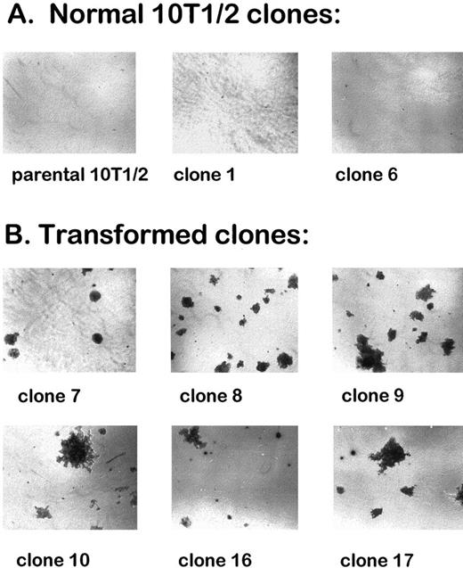 Fig. 1. Growth in soft agar of cells from normal and radiation-transformed 10T1/2 clones. A total of 104 cells were plated in 60-mm dishes in soft agar medium, and photos were taken 2 months later. A, normal 10T1/2 cell clones. B, transformed 10T1/2 cell clones.