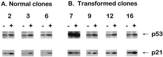 Fig. 2. Examples of Western analysis of p53 and p21 protein levels at 3 h after exposure to 6 Gy. A, normal 10T1/2 cell clones. B, transformed 10T1/2 cell clones. Induction of p53 and p21 protein expression by radiation was quantified by densitometry in all clones (ratios of 2.5–5.0 for p53 and ratios of 1.5–3.0 for p21), except for clone 7, which had a mutation in the p53 gene (ratio 243 1). Symbols are: −, nonirradiated cells; and +, cells that were exposed to 6 Gy.