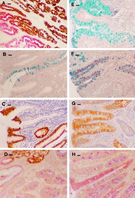 Fig. 1. Histochemical and immunohistochemical (MUC1, MUC2, MUC5AC, and MUC6) staining of normal gastric mucosa and intestinal metaplasia. A, normal gastric mucosa immunohistochemically double stained with monoclonal antibody CLH2 (anti-MUC5AC, red) and monoclonal antibody CLH5 (anti-MUC6, brown). B, gastric mucosa with intestinal metaplasia type I histochemically stained with alcian blue/high iron diamine. C, gastric mucosa with intestinal metaplasia type I immunohistochemically stained with monoclonal antibody HMFG2 (anti-MUC1) showing absence of MUC1 staining in the metaplastic glands. D, gastric mucosa with intestinal metaplasia type I immunohistochemically triple stained with monoclonal antibody CLH2 (anti-MUC5AC, red), monoclonal antibody CLH5 (anti-MUC6, brown), and monoclonal antibody PMH1 (anti-MUC2, blue), showing absence of MUC5AC and MUC6 staining in the metaplastic glands and expression of MUC2 in goblet cells. E and F, gastric mucosa with intestinal metaplasia type II (E) and type III (F), histochemically stained with alcian blue/high iron diamine showing sialomucins in type II (E) and sulfomucins in type III (F) intestinal metaplasia. G, area of intestinal metaplasia type III immunohistochemically stained with monoclonal antibody HMFG2 (anti-MUC1, brown) showing expression of MUC1 in goblet and columnar cells of metaplastic glands. H, area of intestinal metaplasia type III immunohistochemically double stained with monoclonal antibody CLH2 (anti-MUC5AC, red) and monoclonal antibody PMH1 (anti-MUC2, blue) showing expression of MUC5AC and MUC2 in cells of metaplastic glands. Bars, 11.6 μm.