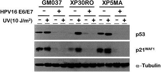 Fig. 4. Effect of transformation with HPV16 E6/E7 genes on expression of p53 and p21WAF1 in three cell lines, as analyzed by Western blotting. Expression of E6/E7-transfected cells (+) was compared with neo-transfected controls (-); in each case, protein samples were collected from either untreated cells (-) or cells irradiated with 10 J/m2 UV light and examined 4 h later (+). α-Tubulin was used as a loading control.