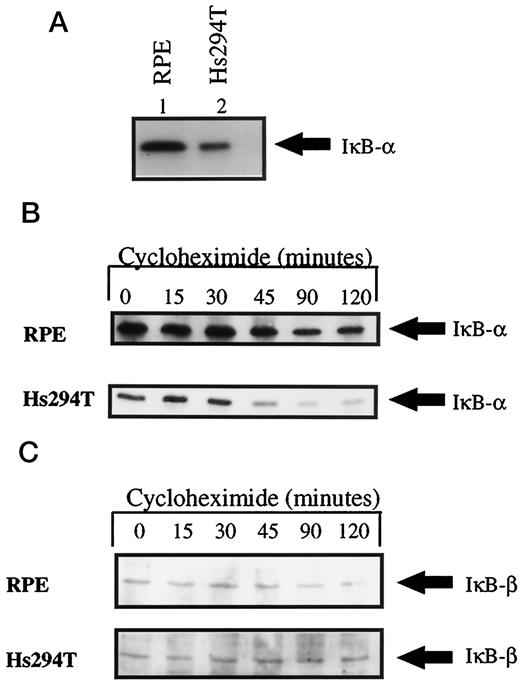 Fig. 1. Hs294T cells contain low levels of IκB-α due to an increased rate of degradation compared with RPE cells. Total cellular protein was solubilized from unstimulated Hs294T or RPE cells in RIPA buffer. Whole-cell extracts (50 μg) were analyzed for IκB-α (A and B) or IκB-β (C) by Western blotting using the respective antibodies. B and C, cells were treated with cycloheximide for time periods indicated to monitor half-life of the protein. There were no differences between RPE and Hs294T cells in the IκB-α protein level or its degradability. Blots for RPE and Hs294T cells were performed simultaneously and exposed to enhanced chemiluminescence for the same length of time to verify differences.
