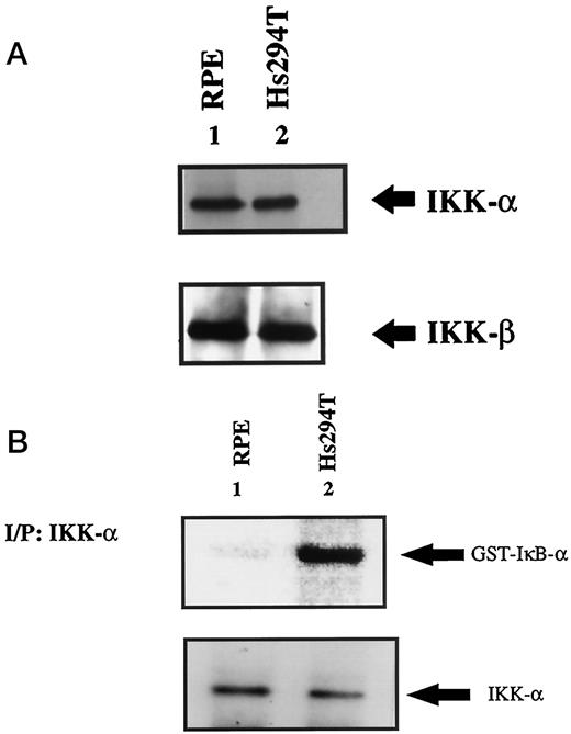 Fig. 3. Hs294T and RPE cells contain similar levels of IKK-α or IKK-β, but the activity of IKK is significantly higher in Hs294T cells. A, whole-cell lysates (50 μg) obtained from unstimulated RPE or Hs294T cells were Western blotted with IKK-α or IKK-β antibody; top panel, IKK-α ; bottom panel, IKK-β. B, 500 μg of whole-cell lysate obtained in nondenaturing immunoprecipitation buffer was immunoprecipitated with IKK-α antibody as outlined in “Materials and Methods.” In vitro IKK kinase activity was measured with the immunoprecipitate using the full-length GST-IκB-α as the substrate according to the protocol described in “Materials and Methods.” The top panel shows phosphorylated GST-IκB-α on an autoradiograph and represents the IKK activity. The blot was normalized by Western blotting with IKK-α antibody.
