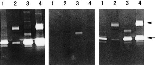 Fig. 1. Inhibition of MMP activity by BPHAs in gelatin zymography. Gelatin zymography of culture supernatants of the Lewis murine lung carcinoma (Lane 1), B16-BL6 murine melanoma (at pH 4.5; Lane 2), Ma44 human lung cancer (Lane 3), and Colon 26 murine colon cancer (Lane 4). Reactions were carried out in reaction buffer only (left), reaction buffer containing BPHA at 20 μm (center), or reaction buffer containing (-)BPHA at 100 μm (right). The experimental protocols are described in “Materials and Methods.” Arrow, gelatinolytic band of MMP-2; arrowhead, gelatinolytic band of MMP-9.