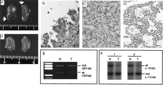 Fig. 2. Tumor development in Tsc2 heterozygous mutant mice. A, RCs in a Tsc2 heterozygous mutant mouse. Kidneys from a 7-month-old female mutant are shown. Arrows indicate spontaneous RCs developing bilaterally. B and C, H&E staining of kidney sections containing RC with cystic (B) or tubular-type features (C). The asterisk in B indicates the lumen of a cyst. Bar, 30 μm. D, kidneys from an 11-week-old female mutant treated with ENU at E 15.0. Note the accelerated development of RCs compared with the kidneys in A. E, detection of LOH by PCR in spontaneous RCs. A representative case of LOH is shown. N, normal tissue; T, tumor. Right, positions and sizes (in parentheses) of amplified products from the wild-type (wt) and mutated (mut) alleles are indicated. F, detection of LOH by Southern blot analysis in spontaneous RCs. Two representative cases of LOH are shown. N, normal tissue; T, tumor. Right, positions and sizes (in parentheses) of fragments from wild-type (wt) and mutated (mut) alleles are indicated. G, H&E staining of a hepatic hemangioma from a Tsc2 heterozygous mutant mouse. Bar, 30 μm.