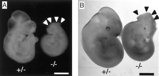 Fig. 3. Typical abnormal appearance of Tsc2 homozygous mutant embryos. Embryos at E 10.0 (A) and E 11.5 (B) from F1 heterozygous breedings are shown (A, dark field; B, light field). Tsc2 heterozygous mutant, +/−; Tsc2 homozygous mutant, −/−. Note the smaller body size of the Tsc2−/− mutants. Arrows indicate the region of failure of neural tube closure. Bar, 750 (A) and 1000 μm (B).