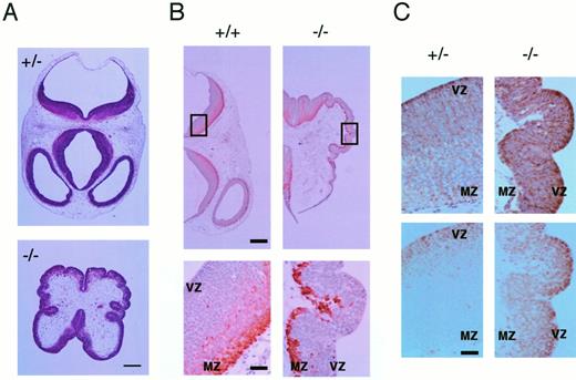 Fig. 4. Histological analysis of neural tubes. A, H&E staining of transverse sections of the head region of Tsc2 homozygous mutant (−/−, bottom panel) and control heterozygous mutant (+/−, top panel) embryos at E 11.5. The former is the most severe example of the consequences of nonclosure of the neural tube found in an E 11.5 Tsc2−/− embryo. The subventricular layer of neural tube is completely exposed to body surface. Bar, 200 μm. B, anti-βIII-tubulin staining of neural tubes of Tsc2 homozygous mutant (−/−) and control wild-type (+/+) embryos at E 11.5. Transverse sections were stained with anti-βIII-tubulin and counterstained with hematoxylin. In each case, the bottom panel is the enlarged view of the region enclosed by a rectangle in the top panel. Note the prominent staining in the marginal layer. VZ, ventricular zone; MZ, marginal zone. Bar, 200 (top panels) and 40 μm (bottom panels). C, anti-nestin and anti-PCNA staining of Tsc2 homozygous mutant (−/−) and control heterozygous (+/−) embryos at E 11.5. As in anti-βIII-tubulin staining (B), neural tubes were stained with anti-nestin followed by a light counterstain with hematoxylin (top panels) or with anti-PCNA followed by a light counterstain with eosin (bottom panels) using serial sections. VZ, ventricular zone; MZ, marginal zone. Bar, 40 μm.