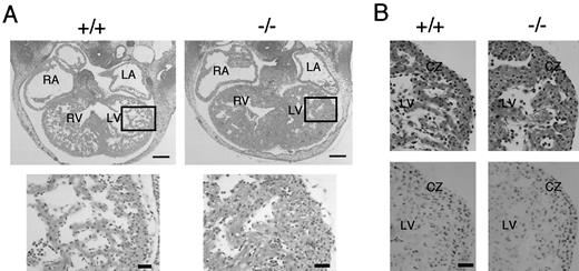 Fig. 5. Histological analysis of embryonic hearts. A, cardiac anomalies in the Tsc2 homozygous mutant. Transverse sections of embryonic hearts from Tsc2 homozygous mutant (−/−, right panels) and control wild-type (+/+, left panels) embryos at E 12.5 were stained with H&E. RA, right atrium; LA, left atrium; RV, right ventricle; LV, left ventricle. Bottom panels are enlarged views of myocardia enclosed in rectangles in the top panels. Bar, 150 (top panels) and 30 μm (bottom panels). B, PCNA staining of embryonic hearts. Ventricular parts of E 11.5 Tsc2 homozygous mutant (−/−, right panels) and control wild-type (+/+, left panels) embryos were stained with H&E (top panels) or with anti-PCNA antibody followed by light counterstain of eosin (bottom panels) using serial sections. LV, left ventricle; CZ, compact zone. Positively stained nuclei were observed throughout both the compact zone and the trabeculated area in both embryos. Bar, 30 μm.