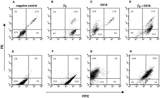 Fig. 4. β3 integrin and CK 18 coexpression in human prostate cancer cells. Freshly isolated (A–D) or primary (E–H) cultures of prostate cancer cells were incubated with serum against the cytoplasmic domain of the β3 integrin and labeled using FITC-conjugated antibody to rabbit IgG (B and F) or with a monoclonal antibody antihuman CK 18 and labeled using PE-conjugated antibody to murine IgG (C and G). D and H, cells were double stained with antibodies to β3 integrin and to CK 18, followed by FITC- and PE-conjugated antibodies. As negative control, double-staining was performed using nonimmune rabbit serum and 1C10 monoclonal antibody (A and E), followed by FITC- and PE-conjugated antibodies. Fluorescence intensity is expressed in arbitrary units. The experiment was repeated using either three or two independently obtained prostate cell populations with consistent results. A–H, a representative dot plot showing staining for β3 on the horizontal axis and for CK 18 on the vertical axis is shown; the percentage of cells expressing the single epitope is shown. D and H, CK 18-positive cells express β3 (top right). G, a typical cell population in primary culture was composed of 89% epithelial cells (top left).