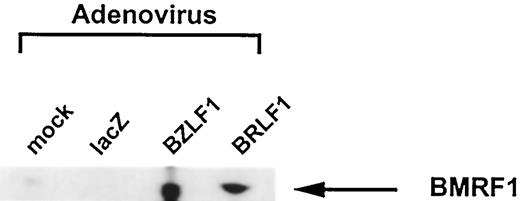 Fig. 7. Induction of lytic EBV infection in Jijoye tumors in vivo. Jijoye cell tumors were grown s.c. in SCID mice and directly inoculated with the lacZ-, BZLF1-, or the BRLF1-expressing adenovirus vectors. Two days later, the mice were sacrificed and tumor extracts were examined for expression of the lytic EBV protein, BMRF1, using immunoblot analysis.