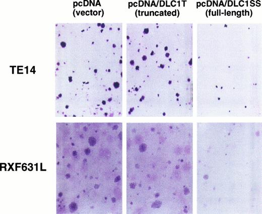 Fig. 5. Colony-formation assay. The photographs are of flasks containing cells from esophageal cancer cell line TE14 and renal cancer cell line RXF631L with pcDNA3.1(+) vector, pcDNA3.1(+)/DLC1T (truncated) cDNA, or pcDNA3.1(+)/DLC1SS (full-length), after geneticin (G418) selection for 14 days.