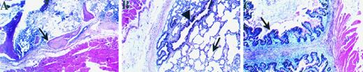 Fig. 1. SCID-hu tissue implants. Histological appearance of human fetal tissues 4 weeks after implantation into SCID mice. A, the marrow compartment of human bone implants contained mainly stromal elements and some residual hematopoietic cells, and evidence of new bone formation could be seen (arrow). ×40. B, implanted human lung with alveolar structures (arrow) and columnar epithelium lining bronchioles (arrowhead). ×40. C, implanted human fetal intestine appeared healthy, with a well-differentiated epithelial lining (arrow). ×40. No evidence of necrosis was seen in any tissue examined.
