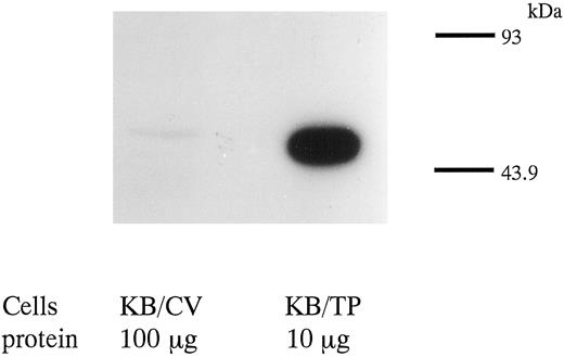 Fig. 2. Immunoblot analysis of TP in KB/CV and KB/TP cells. KB/CV and KB/TP cytosols (100 and 10 μg of protein, respectively) were separated by SDS-PAGE and transferred to a polyvinylidene difluoride membrane. TP levels in the cytosols were determined using a monoclonal antibody against TP.