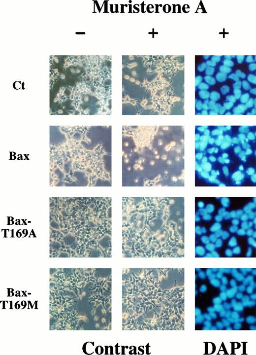 Fig. 3. Effect of induction of Bax, Bax-T169A, and Bax-T169M expression on apoptosis of 293 cells. Cells were incubated in the absence (−) or in the presence (+) of 5 μm muristerone A for 48 h and examined by phase contrast microscopy or stained with DAPI and examined at 24 h by fluorescence microscopy. Ct, control cells.