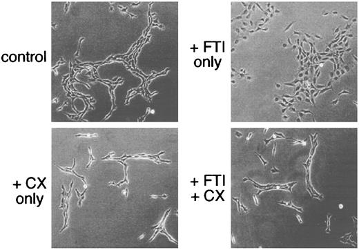 Fig. 1. Protein synthesis inhibitors block reversion of the Ras-transformed phenotype by FTIs. Where indicated, Rat1/ras cells were treated 6 h with 10 μg/ml cycloheximide (which inhibits protein synthesis >95%) in the presence or absence of 20 μ m FTI L-739,749. After this treatment, cells were washed and replenished with normal growth media or growth media containing 20 μm FTI L-739,749. Cell morphology was documented by photography 30 h later. CX, cycloheximide.