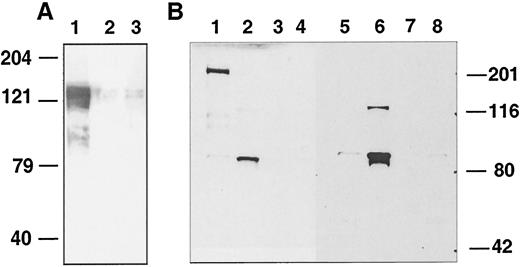 Fig. 2. Coprecipitation experiment using MMAC1/PTEN PDZBD peptides and A431 human cell lyaste. A, the biotinylated peptides MMAC1/PTEN-PDZBD (Lane 1),MMAC1/PTEN-pThrPDZBD (Lane 2), and Src-SH3BD (Lane 3) were prebound to streptavidin magnetic beads,then incubated with A431 cell lysate. Following repeated washes, the bound molecules were recovered by boiling in SDS sample buffer,resolved by SDS-PAGE, transferred to a nitrocellulose membrane,blocked, then probed with an anti-hDLG antibody. The detected Mr 140,000 band is at the size expected for hDLG. B, the peptides MMAC1/PTEN-PDZBD (Lanes 1 and 5), MMAC1/PTEN-pThrPDZBD (Lanes 2 and 6), and Src-SH3BD (Lanes 3and 7) were incubated with A431 cell lysate and resolved by SDS-PAGE along with crude lysate (Lanes 4 and 8), as described above. Unlike A, bound proteins were detected with MMAC1/PTEN-PDZBD (Lanes 1–4) and MMAC1/PTEN-pThrPDZBD (Lanes 5–8)peptides precomplexed to peroxidase.