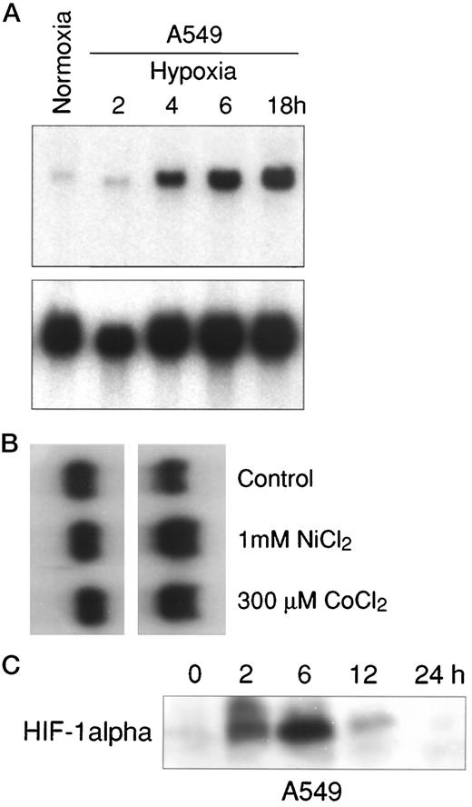 Fig. 1. Induction of Cap43 and GAPDHgene expression in A549 cell by metals or hypoxia. A,induction of Cap43 gene expression by hypoxia. A549 cells were exposed to hypoxia (0.5% O2) for the time periods indicated in the figure. Fifteen μg of total RNA were isolated and subjected to a Northern blot analysis. The blot was first hybridized with the Cap43 probe (top);then the membrane was stripped and rehybridized with β-actin(bottom). B, induction of GAPDH gene expression in A549 cell by metals. A549 cells were exposed to 1 mm NiCl2 or 300μ m CoCl2 for 20 h. Fifteen μg of total RNA were isolated and subjected to a Northern blot analysis. The blot was first hybridized with the GAPDH probe(top); then the membrane was stripped and rehybridized with β-actin (bottom). C, time course of HIF-1α induction by hypoxia in A549 cells. A549 cells were exposed to hypoxic conditions (0.5% O2) for the time periods indicated in the figure. Forty μg of nuclear extracts were subjected to Western blot analysis.