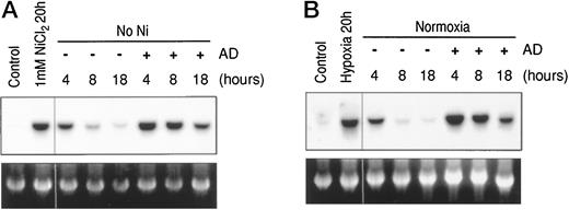 Fig. 3. Stability of Cap43 mRNA in cells treated with nickel or exposed to hypoxic conditions. A,stabilization of nickel-induced Cap43 mRNA by AD. A549 cells were treated with 1 mm NiCl2 for 20 h. The inducer was washed away, and cells were incubated with or without 4 μm of AD for an additional 4, 6, or 18 h. Fifteen μg of total RNA were subjected to Northern blot analysis as described in “Materials and Methods” using the Cap43probe (top). Ethidium bromide staining was used to adjust loading (bottom). B, stabilization of Cap43 mRNA by AD in cells exposed to hypoxic conditions. Cells were exposed to hypoxic conditions (0.5%O2) for 20 h and then incubated in the absence and presence of AD (4 μm) for an additional 4, 6, or 18 h. Cap43 mRNA was assessed as described in “Materials and Methods” by Northern blot analysis.