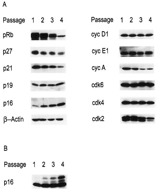 Fig. 3. Steady-state levels of G1-S-associated cell cycle regulators during the aging of the prostatic epithelial cell population. A, lysates were collected from prostatic epithelial cells between early passage (passage 1) and senescence (passage 4). Cell lysates from the indicated passage numbers were resolved by SDS-PAGE and immunoblotted with the indicated antibodies. B, longer exposure of p16 immunoblot from A. cyc, cyclin.