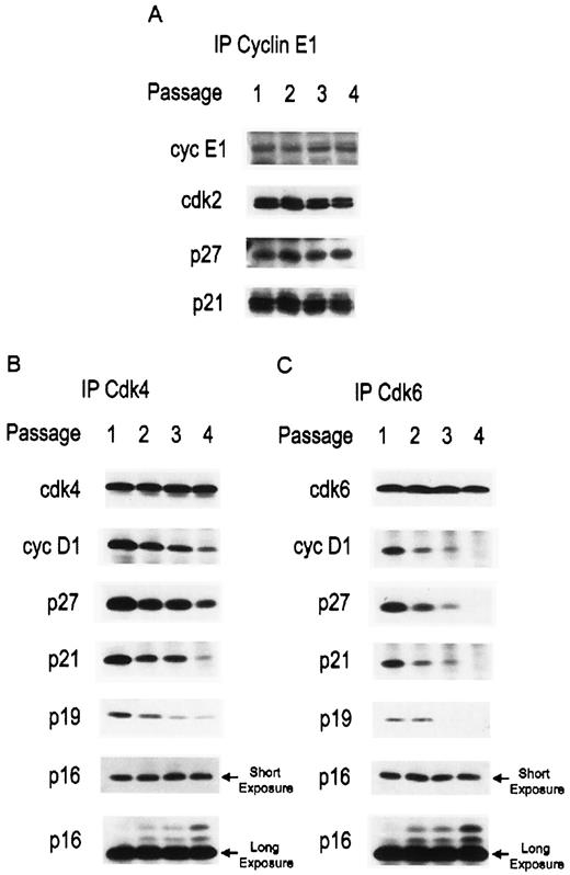 Fig. 4. Cyclin/cdk inhibitor complexes in prostatic epithelial cells from early passage to senescence. Cyclin (A) or cdk (B and C) immunoprecipitations were carried out as described in “Material and Methods.” Complexes from the indicated passages were resolved and immunoblotted for associated cdk, cyclin, and cdk inhibitors. A, cyclin E1(cyc E1) binding to cdk2 and cdk inhibitors p21 and p27. B, cdk4 binding to cyclin D1 (cyc D1) and cdk inhibitors p16, p19, p21, and p27. C, cdk6 binding to cyclin D1 (cyc D1) and cdk inhibitors p16, p19, p21,and p27.