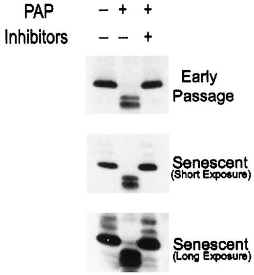 Fig. 5. p16 phosphorylation in senescent cells. Cdk6 complexes from early passage and senescent cellular extracts were immunoprecipitated and treated with PAP in the presence or absence ofβ-glycerophosphate (inhibitor). Complexes were then resolved and immunoblotted for p16. +, present; −, absent.