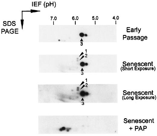 Fig. 6. 2D IEF of cdk6-associated p16. Cdk6 complexes from early passage and senescent extracts were immunoprecipitated and treated (or not) with PAP as indicated. Complexes were resolved in the first dimension by IEF and in the second dimension by SDS-PAGE. Gels were transferred and p16 was immunoblotted. Arrowhead 1,isoform 1, found in senescent cells, which showed delayed mobility on SDS-PAGE; arrowhead 2, isoform 2, found in senescent cells, which showed delayed mobility on SDS-PAGE; arrowhead 3, two forms of p16, found in early passage and senescent cells, which focused to a pH between 5 and 6.