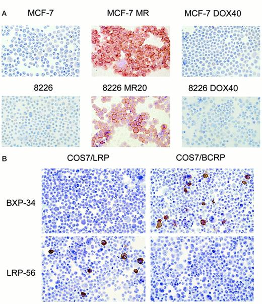 Fig. 1. A, staining of cytospins of parental and drug-selected sublines of MCF-7 (breast cancer) and 8226 (myeloma)human tumor cells with the BXP-34 Mab. The MR sublines are MX-selected and the Dox sublines are Dox-selected (see Table 1<$REFLINK>). B,COS7 cells transfected with LRP (control; left panel) or BCRP cDNA(right panel) stained with LRP-56 control Mab(lower panel) and BXP-34 Mab (upper panel). Biotinylated rabbit-antimouse serum and HRP-labeled streptavidin were used as secondary reagents. Color development was with AEC.