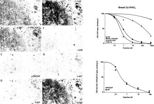 Fig. 1. Detection of the VPAC1 receptor subtype in invasive ductal breast carcinoma and the surrounding breast tissue. A, H&E-stained section. Tu, carcinoma; Br, normal breast tissue. Bar, 1 mm. B–D, autoradiograms showing 125I-PACAP binding. B, 125I-PACAP total binding. C, binding in the presence of 20 nm PACAP. D, binding in the presence of 20 nm VIP. E–H, autoradiograms showing 125I-VIP binding. E, 125I-VIP total binding. F, binding in the presence of 20 nm VIP. G, binding in the presence of 20 nm of the VPAC1-selective analogue (sV1)KRL-VIP/GRF. H, binding in the presence of 20 nm of the VPAC2-selective analogue(sV2) RO 25-1553. The tumor and normal breast tissues are labeled with 125I-PACAP and 125I-VIP. Complete displacement by 20 nm PACAP and VIP excludes the presence of PAC1. Complete displacement by 20 nm KRL-VIP/GRF but not RO 25-1553 strongly suggests expression of VPAC1 in both tissues. On the right, the two competition curves reveal the VPAC1 expression of breast carcinoma: the top graph shows high affinity displacement of 125I-VIP by KRL-VIP/GRF but not by RO 25-1553; the bottom graphshows high affinity displacement of 125I-PACAP by PACAP and VIP.