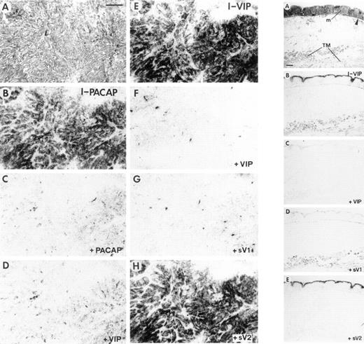 Fig. 3. Left panels A–H,VPAC1 in human gastric carcinoma. A,H&E-stained section. Bar, 1 mm. B–D,autoradiograms showing 125I-PACAP binding. B, 125I-PACAP total binding. C, binding in the presence of 20 nm PACAP. D, binding in the presence of 20 nm VIP. E–H, autoradiograms showing 125I-VIP binding in gastric carcinoma tissue. E, 125I-VIP total binding. F, binding in the presence of 20 nm VIP. G, binding in the presence of 20 nm of the VPAC1-selective analogue (sV1) KRL-VIP/GRF. H, binding in the presence of 20 nm of the VPAC2-selective analogue (sV2) RO 25-1553. Right panelsA–E, normal gastric wall with VPAC1 in mucosa (m) and VPAC2 in the tunica muscularis (TM). A, H&E-stained section. Arrowhead, muscularis mucosae. Bar, 1 mm. B–E, autoradiograms showing 125I-VIP binding in analogy to left panels E–H. B, 125I-VIP total binding. C,binding in the presence of 20 nm VIP. D,binding in the presence of 20 nm of the VPAC1-selective analogue (sV1) KRL-VIP/GRF. F, binding in the presence of 20 nm of the VPAC2-selective analogue (sV2) RO 25-1553. The mucosa has the same VPAC1 characteristics as the gastric carcinoma, whereas the smooth muscle expresses VPAC2.
